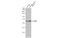 ETS Variant 1 antibody, GTX129202, GeneTex, Western Blot image 