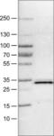 PGAM Family Member 5, Mitochondrial Serine/Threonine Protein Phosphatase antibody, NBP2-52947, Novus Biologicals, Western Blot image 