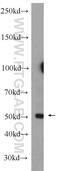 Ectonucleoside Triphosphate Diphosphohydrolase 1 antibody, 14211-1-AP, Proteintech Group, Western Blot image 