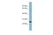 Glutaminyl-TRNA Amidotransferase Subunit QRSL1 antibody, A13528, Boster Biological Technology, Western Blot image 