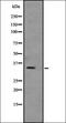 Troponin T3, Fast Skeletal Type antibody, orb335089, Biorbyt, Western Blot image 
