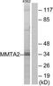 Chromosome 1 Open Reading Frame 35 antibody, TA315777, Origene, Western Blot image 