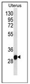 Ring Finger Protein 148 antibody, AP53684PU-N, Origene, Western Blot image 