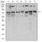 Glucosamine--fructose-6-phosphate aminotransferase [isomerizing] 1 antibody, NBP2-52472, Novus Biologicals, Western Blot image 