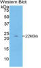 p21 antibody, LS-C293595, Lifespan Biosciences, Western Blot image 