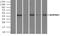 Alpha-1-antitrypsin antibody, NBP1-47957, Novus Biologicals, Immunoprecipitation image 
