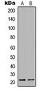 Claudin 3 antibody, LS-B15522, Lifespan Biosciences, Western Blot image 