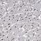 Alpha Kinase 3 antibody, HPA026558, Atlas Antibodies, Immunohistochemistry frozen image 