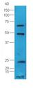 Diazepam Binding Inhibitor, Acyl-CoA Binding Protein antibody, orb182416, Biorbyt, Western Blot image 