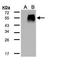 Transforming growth factor beta-1-induced transcript 1 protein antibody, GTX108510, GeneTex, Western Blot image 