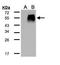 Transforming Growth Factor Beta 1 Induced Transcript 1 antibody, GTX108510, GeneTex, Western Blot image 