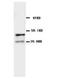 Cholinergic Receptor Nicotinic Alpha 1 Subunit antibody, LS-C171634, Lifespan Biosciences, Western Blot image 