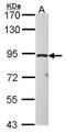 Taste 1 Receptor Member 1 antibody, NBP2-20571, Novus Biologicals, Western Blot image 