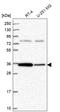 Serine And Arginine Rich Splicing Factor 2 antibody, HPA049905, Atlas Antibodies, Western Blot image 