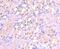 Sp1 Transcription Factor antibody, NBP2-67159, Novus Biologicals, Immunohistochemistry paraffin image 
