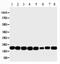 NME/NM23 Nucleoside Diphosphate Kinase 1 antibody, PA5-79742, Invitrogen Antibodies, Western Blot image 