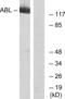 ABL Proto-Oncogene 1, Non-Receptor Tyrosine Kinase antibody, LS-C118040, Lifespan Biosciences, Western Blot image 