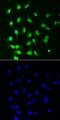 Protein Kinase C Beta antibody, AF3759, R&D Systems, Western Blot image 