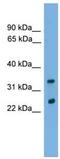 Charged Multivesicular Body Protein 4B antibody, ab105767, Abcam, Western Blot image 