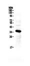 Insulin Like Growth Factor Binding Protein 2 antibody, PA5-79449, Invitrogen Antibodies, Western Blot image 