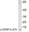 Centromere Protein A antibody, LS-C292248, Lifespan Biosciences, Western Blot image 