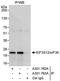 Eukaryotic Translation Initiation Factor 3 Subunit K antibody, A301-762A, Bethyl Labs, Immunoprecipitation image 