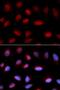 Transcortin antibody, LS-B13886, Lifespan Biosciences, Immunofluorescence image 