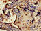 CREB Regulated Transcription Coactivator 1 antibody, CSB-PA757785LA01HU, Cusabio, Immunohistochemistry paraffin image 