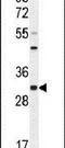 Rab Interacting Lysosomal Protein Like 2 antibody, PA5-24505, Invitrogen Antibodies, Western Blot image 