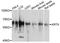 Keratin 9 antibody, A03692, Boster Biological Technology, Western Blot image 