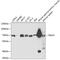 TNF Receptor Associated Factor 3 antibody, GTX64473, GeneTex, Western Blot image 