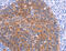 Protein Tyrosine Phosphatase Non-Receptor Type 13 antibody, MBS2520066, MyBioSource, Immunohistochemistry paraffin image 