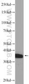 Deltex E3 Ubiquitin Ligase 3 antibody, 25304-1-AP, Proteintech Group, Western Blot image 