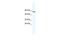 GATA Zinc Finger Domain Containing 2A antibody, GTX48987, GeneTex, Western Blot image 