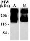 Glutamate Metabotropic Receptor 5 antibody, NB300-126, Novus Biologicals, Western Blot image 