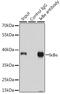 NFKB Inhibitor Alpha antibody, GTX35198, GeneTex, Immunoprecipitation image 