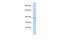 Zinc finger protein ZFAT antibody, A11438, Boster Biological Technology, Western Blot image 