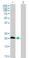 Zinc Finger DHHC-Type Containing 7 antibody, H00055625-B01P, Novus Biologicals, Western Blot image 