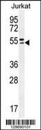 Tripartite Motif Containing 59 antibody, 55-955, ProSci, Western Blot image 