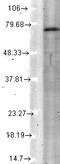 Potassium Voltage-Gated Channel Subfamily Q Member 4 antibody, GTX41990, GeneTex, Western Blot image 