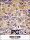 Protein Arginine Methyltransferase 3 antibody, 55-021, ProSci, Immunofluorescence image 