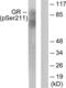 Nuclear Receptor Subfamily 3 Group C Member 1 antibody, LS-C199016, Lifespan Biosciences, Western Blot image 