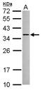 Arginine And Serine Rich Protein 1 antibody, NBP2-15641, Novus Biologicals, Western Blot image 