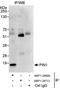 Peptidylprolyl Cis/Trans Isomerase, NIMA-Interacting 1 antibody, NBP1-28699, Novus Biologicals, Immunoprecipitation image 