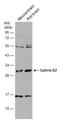 Ephrin A2 antibody, GTX133236, GeneTex, Western Blot image 