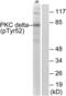 Protein Kinase C Delta antibody, LS-C199451, Lifespan Biosciences, Western Blot image 