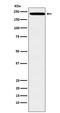 Zinc Finger E-Box Binding Homeobox 1 antibody, M00548, Boster Biological Technology, Western Blot image 