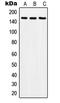 SOS Ras/Rho Guanine Nucleotide Exchange Factor 2 antibody, LS-C352862, Lifespan Biosciences, Western Blot image 