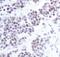 Chromobox 5 antibody, MA5-14989, Invitrogen Antibodies, Immunohistochemistry paraffin image 