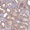 Protein Phosphatase, Mg2+/Mn2+ Dependent 1J antibody, NBP2-13797, Novus Biologicals, Immunohistochemistry frozen image 